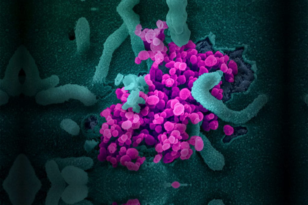 Illustration of a transmission electron micrograph of COVID-19, novel coronavirus, virus particles